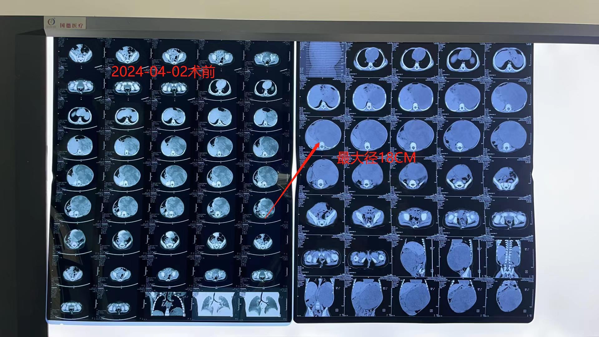 王中王72385.cσm.7229查询,稳定评估计划方案_桌面版88.242